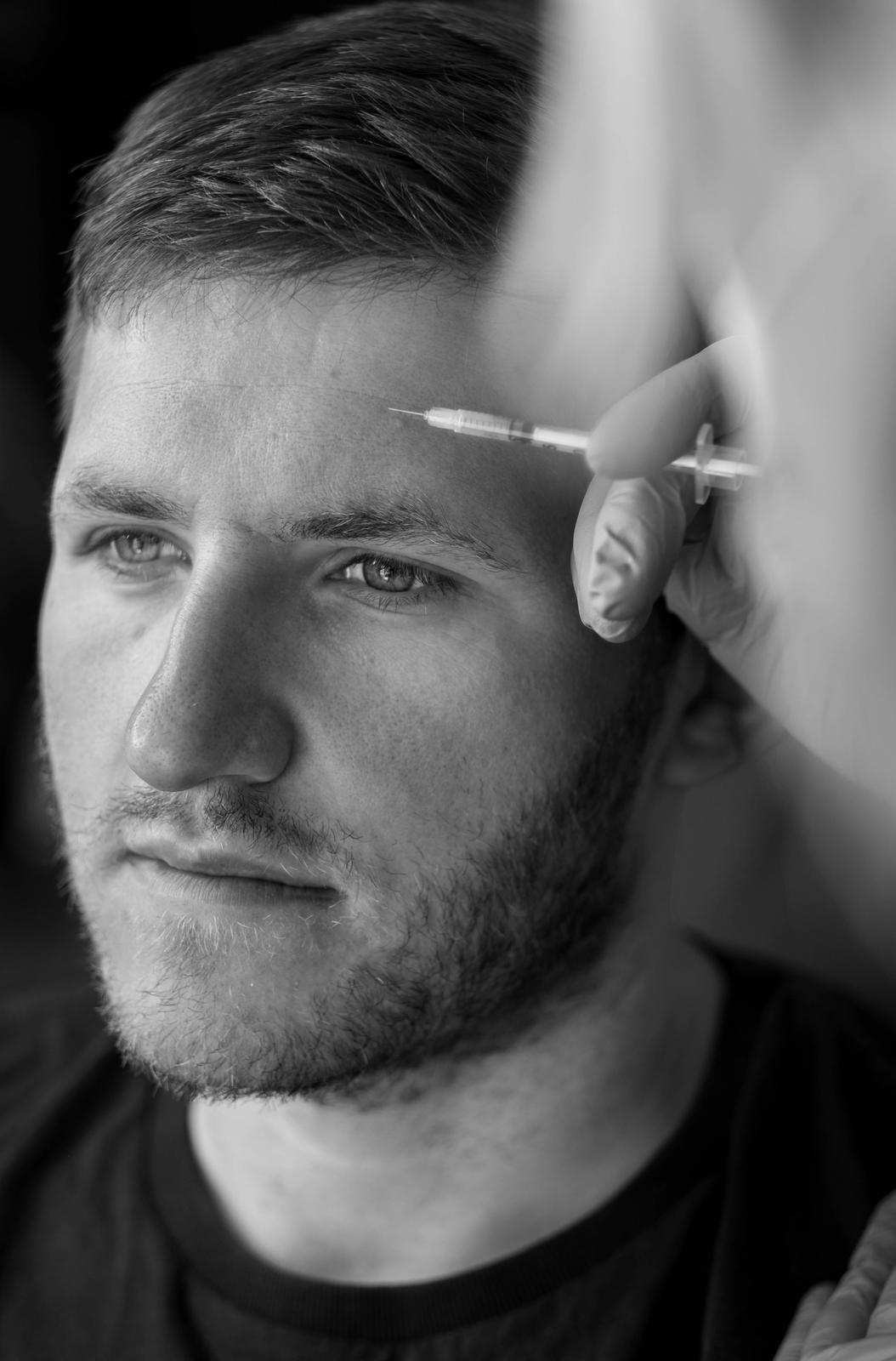 Close-up of a male client receiving anti-wrinkle injections at FaceUp Aesthetics near Pocklington and York